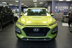 Hyundai Kona 1.0 T-GDI 115.043 km 11.480 &euro; Euskirchen 53881